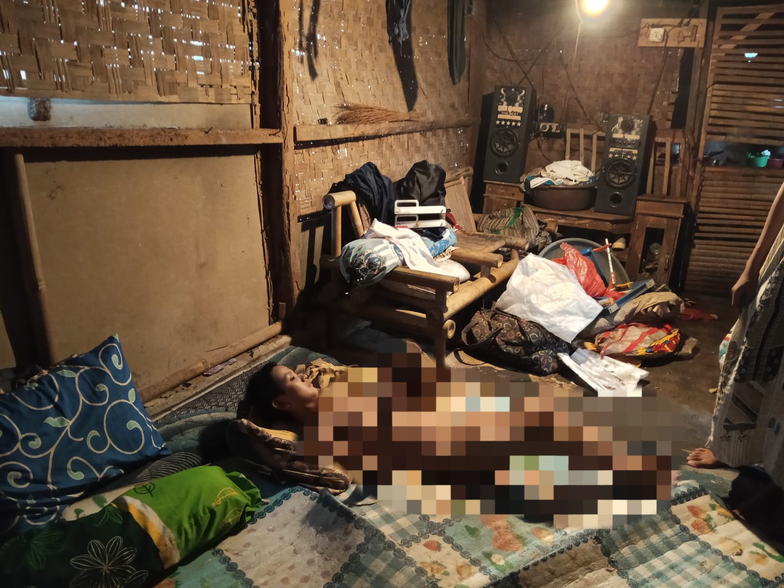Pilu, Siti Anak Berkebutuhan Khusus Terbaring Sejak Bayi, BPJS Tak Aktif dan Belum Pernah Terima Bantuan